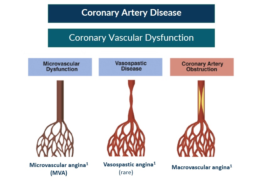 three types of coronary artery disease